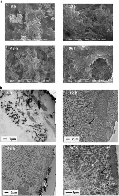 Sem And Tem Observation Of Biofilms A Sem B Tem The Side Of The