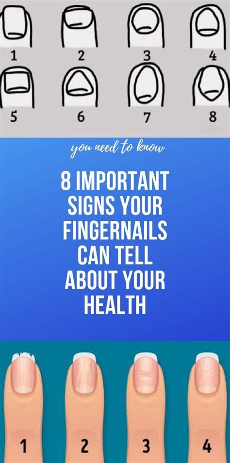 Fingernail Health Signs