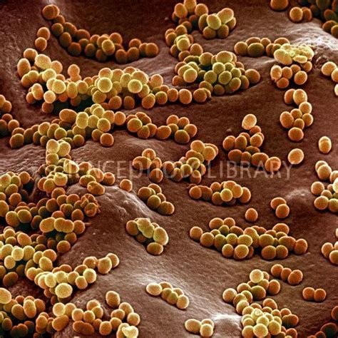 15 Best Staph Aureus Micro Images On Pinterest Microbiology Nurses