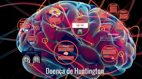 Doença De Huntington By Marina Pagot On Prezi