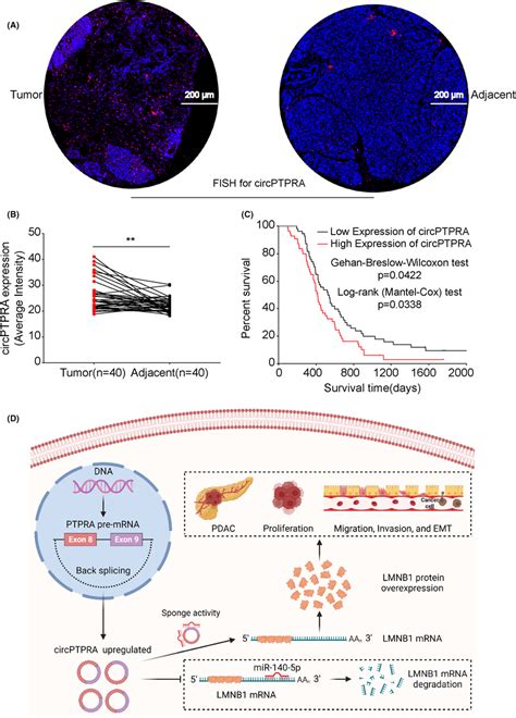 Overexpression Of Circptpra Is Closely Associated With Local Lymph Node