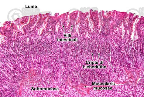 Uomo Intestino Tenue Duodeno Sezione Trasversale X Intestino