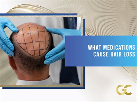 What Medications Cause Hair Loss Gold City Best Hair Transplant Turkey