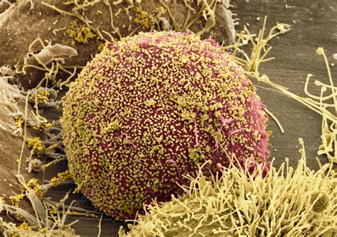 Cell Infected With Hiv Sem Stock Image C Science Photo