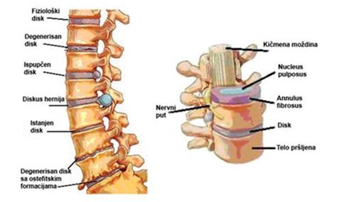 Diskus Hernija Pitajte Doktora