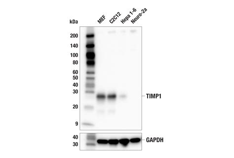 Timp1 E1y1u Rabbit Mab Cell Signaling Technology