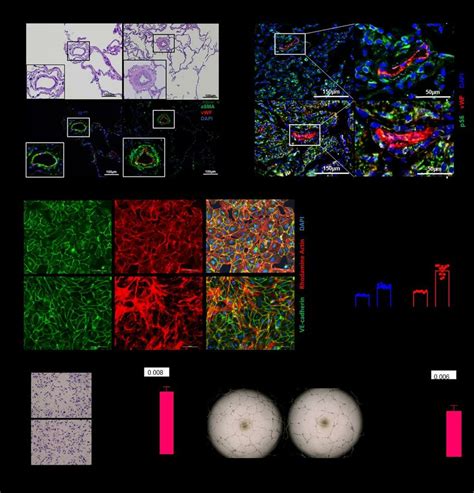 Characterization Of Pulmonary Ecs From Patients With Lam A Download Scientific Diagram