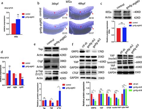 Gmfg Regulates Yap Activity A Quantitative RT PCR Analysis Of Klf2a