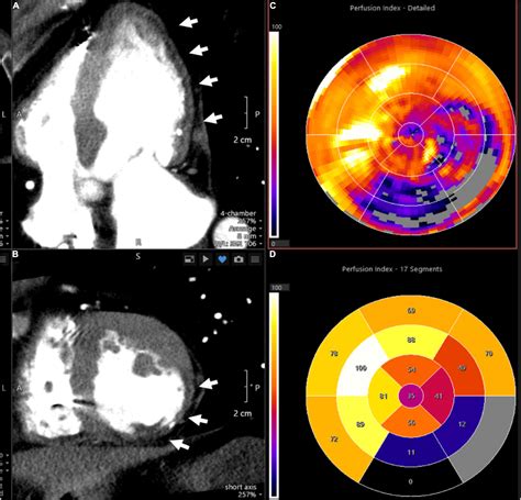 Frontiers Imaging Assessment Of Endothelial Function An Index Of