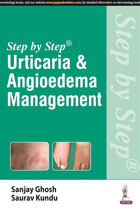 Buy Step By Step Urticaria And Angioedema Management Book Online At Low