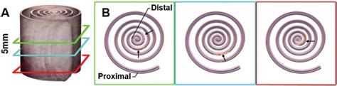 Methodology For Tissue Preparation And Histology Swiss Roll A The Download Scientific