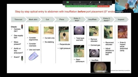 Lecture - "Primary Port Placement" by Prof. Philippe Grange | Johnson ...