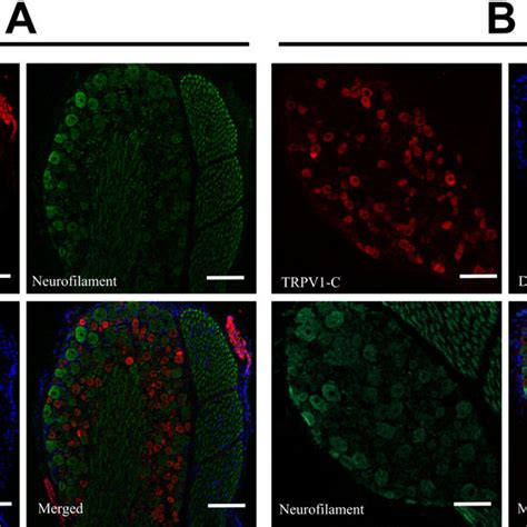 Expression Of Trpv1 In The Skin Immunohistochemistry Was Performed In