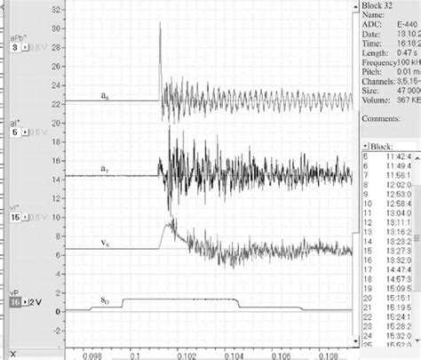 Oscillograms Of Signals In Powergraph Top Downward Accelerations