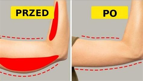 Prostych Wicze Kt Re Pomog Ci Si Pozby Obwis Ych Ramion Zobacz
