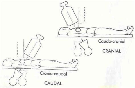 Pedi Cardiology Cath Caudo Cranial Vs Cranio Caudal Projection