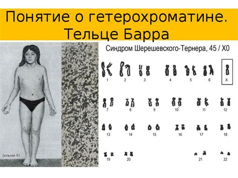 ГЕНЕТИКА