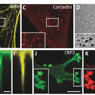 Crp Localizes To Active Invadopodia A D Crp Gfp Localizes To