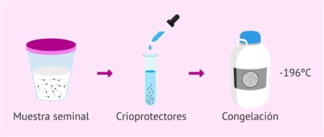 Tecnica De Congelacion Ovodonante