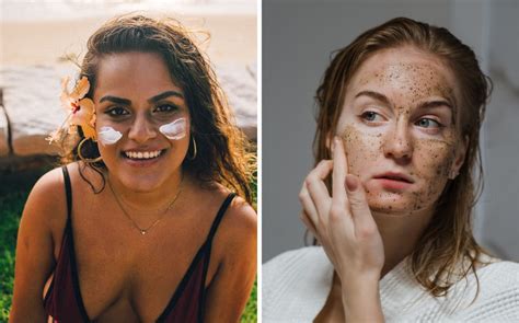 Manchas Solares En El Rostro Cómo Prevenirlas Y Tener Una Piel Bella