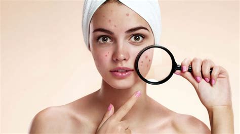 Best Acne Facial Treatment In Orange County About Skin In Lake Forest