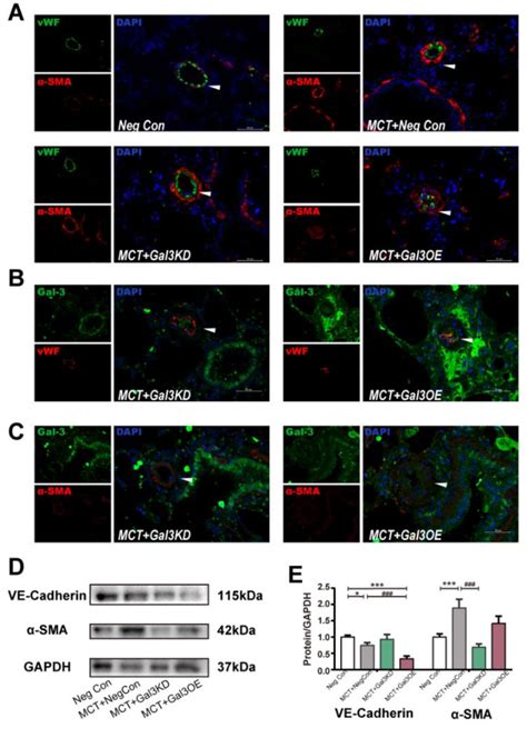 Gal 3 Knockdown Can Alleviate MCT Related Vascular Hypertrophy Through