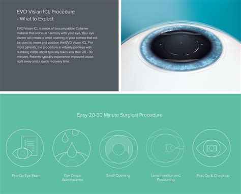 Explore The Benefits Of Evo Visian Icl Lens Connecticut Eye Specialists