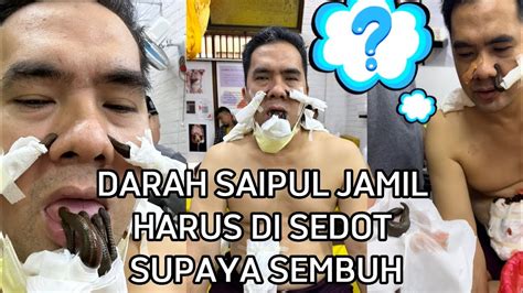 Lintah Hisap Darah Saipul Jamil Terapi Lintah Youtube