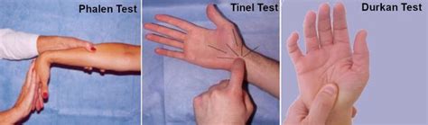 Carpal Tunnel Self Test