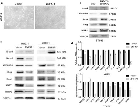 Znf471 Attenuates The Epithelial Mesenchymal Transition Emt And