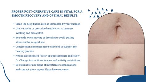 How Umbilicoplasty Fixes a Herniated Belly Button after Pregnancy