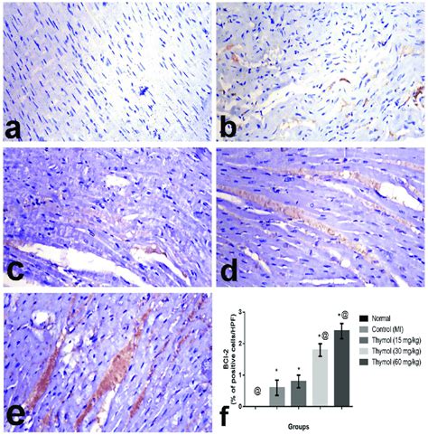 Photomicrograph Of Heart Tissue Immunohistochemically Stained With