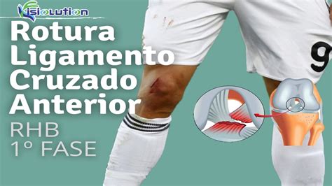 Ligamento Cruzado Anterior REHABILITACIÓN con EJERCICIOS 1º FASE