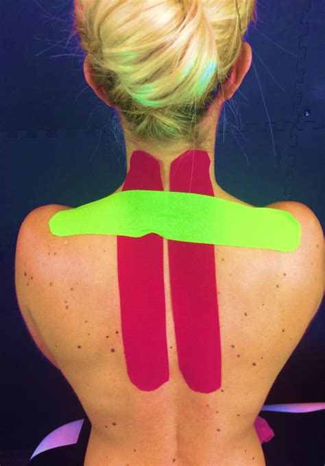 The Best Functional Taping Protocol for Neck Pain