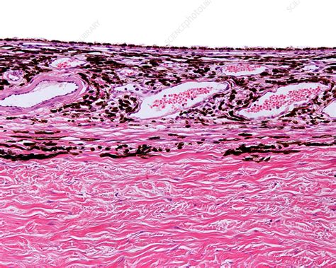 Sclera And Choroid Light Micrograph Stock Image C