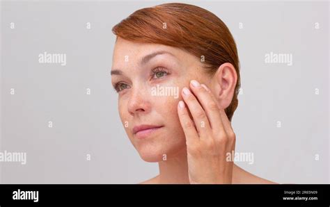 Portrait Of Cropped Caucasian Middle Aged Woman Face With Freckles Touching Skin By Hand On