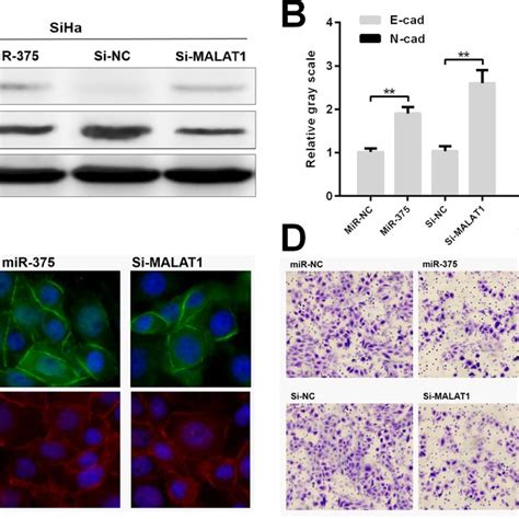 MiR 375 Can Suppress EMT Of Cervical Cancer Cells Partly Via