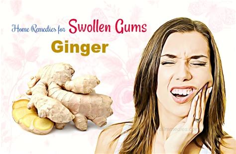 20 Useful Home Remedies for Swollen Gums Around Tooth