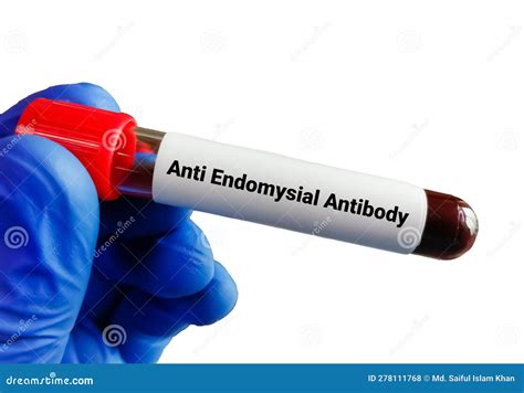 Anti Endomysial Antibody Test For The Diagnosis Of Celiac Disease Stock