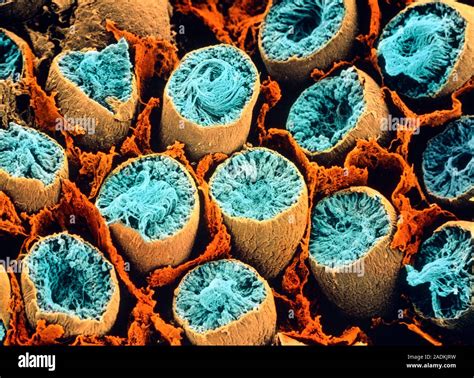 Seminiferous Tubules Coloured Scanning Electron Micrograph Sem Of