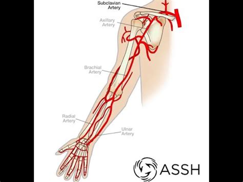 ÜST EKSTREMİTE ARTERLERİ YouTube