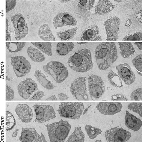 Transmission Electron Micrographs Of Murine Fetal Rib Cartilage