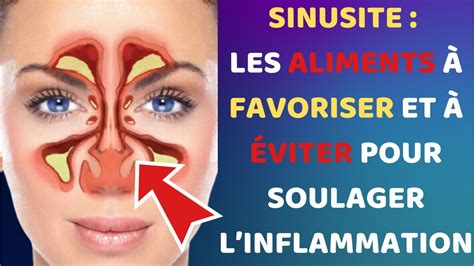 Sinusite quels aliments privilégier et éviter pour soulager l