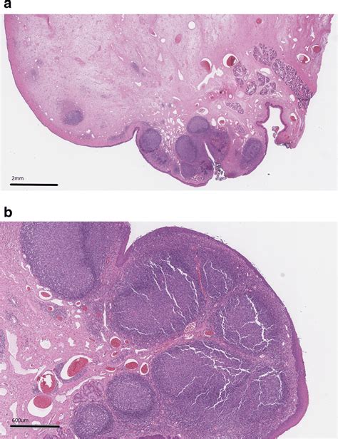 A And B Photomicrographs Of A Histopathology Slide A 1x Magnification Download Scientific