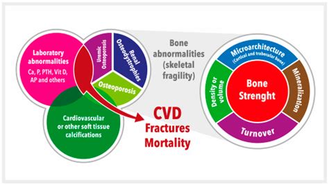 Vitamin D And Ckd With Bone Disorder Encyclopedia Mdpi