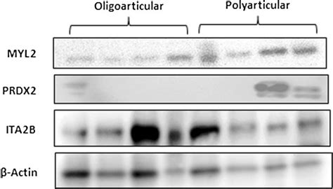 Validation Of Protein Expression Changes By Western Immunoblot Probing