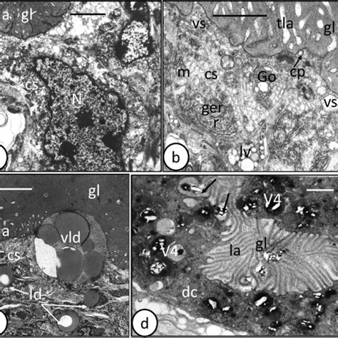 Transmission Electron Microscope Tem Photomicrographs Of Adult And