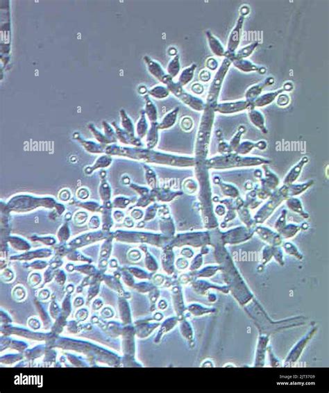 trichoderma  res stock photography  images alamy