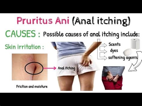 Anal Itching Pruritus Ani Symptoms Causes TESTS AND DIAGNOSIS