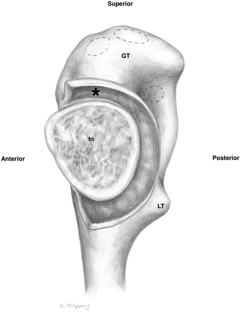 New Findings In Hip Capsular Anatomy Dimensions Of Capsular Thickness